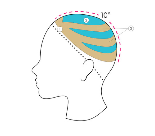 Chanel women's hair replacement system