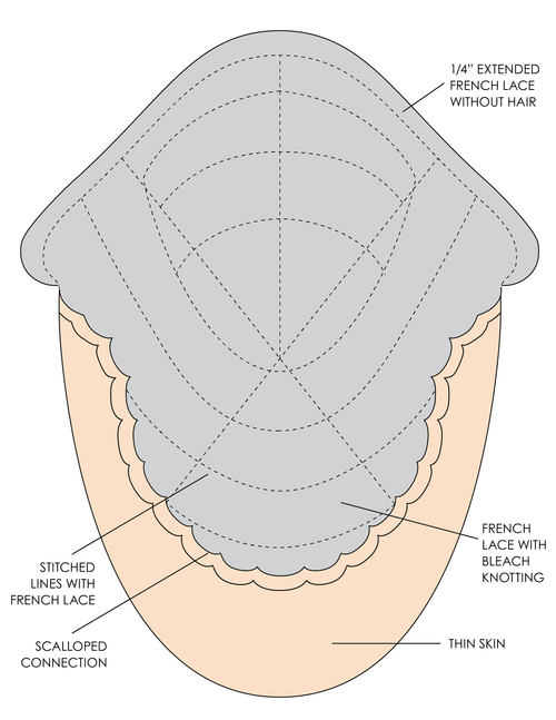 Philippe men's hair replacement system