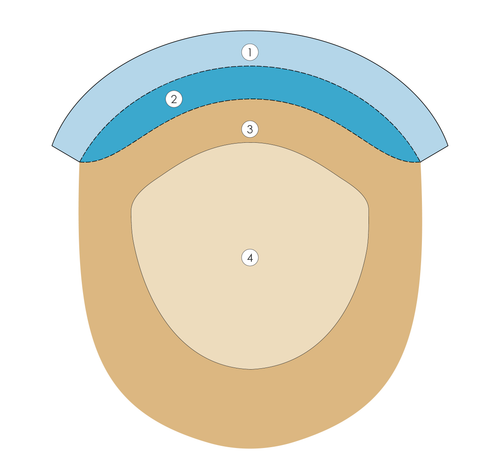 Simone women's hair replacement system